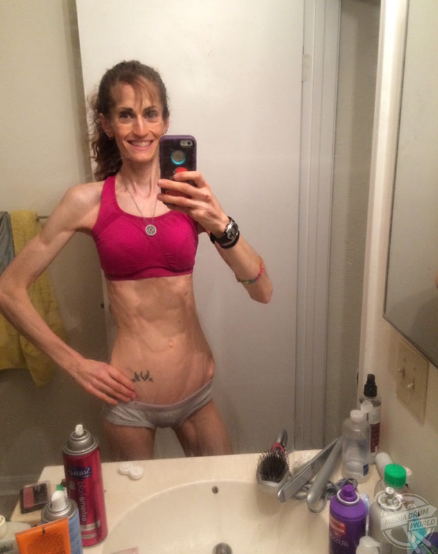 Inspirational Transformation As This Woman Suffered From Bone Breaking