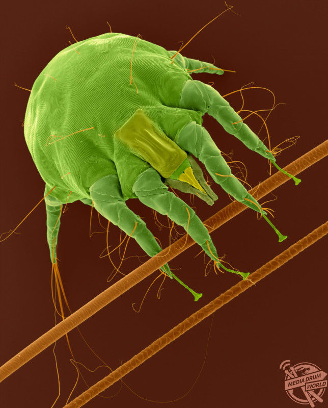 Coloured scanning electron micrograph (SEM) of Rabbit ear mite (Psoroptes cuniculi). Psoroptes cuniculi mites are non-burrowing, and chew/pierce the skin in the ear canal of rabbits causing psoroptic mange. Often a secondary bacteria infection develops, which can extend to the middle and inner ear causing torticollis. In addition, with a severe infestation, the mites may extend to the head, neck, and other parts of the body. These mites cause intense itching and often rabbits will scratch and shake their heads, which can lead to further infection. Their life span is approximately 21 days. Magnification: x35 when shortest axis printed at 25 millimetres. SPL / mediadrumworld.com