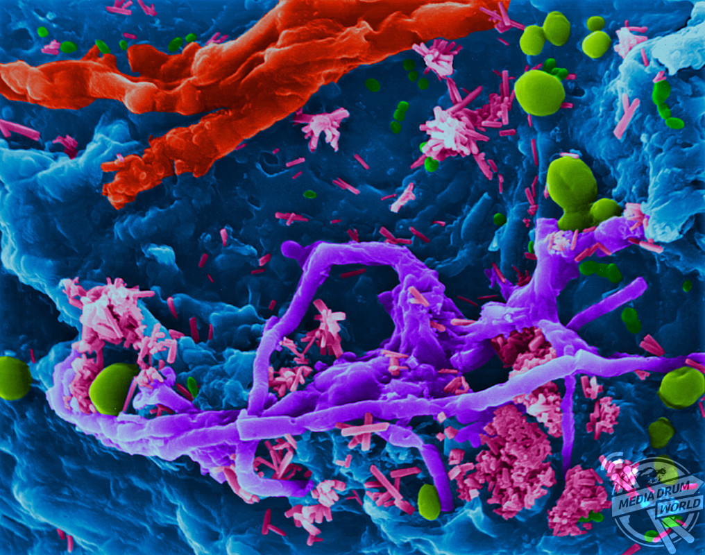 Coloured scanning electron micrograph (SEM) of Kitchen sponge microbes. Kitchen sponges can accumulate food and microbes when used for long periods of time and are not thoroughly cleaned. The moisture and food particles in a dirty sponge make it a perfect environment for microorganisms to grow (such as, bacteria and fungi). Their waste products give the sponge a distinctive smell. Features shown in this photomicrograph are: sponge surface (blue); bacteria (rod-shaped, purple and green colours); filamentous fungi (thin and thick filaments, purple and red colours); yeast fungi (round spheres, yellow, Green colour). Magnification: x580 when shortest axis printed at 25 millimetres. SPL / mediadrumworld.com
