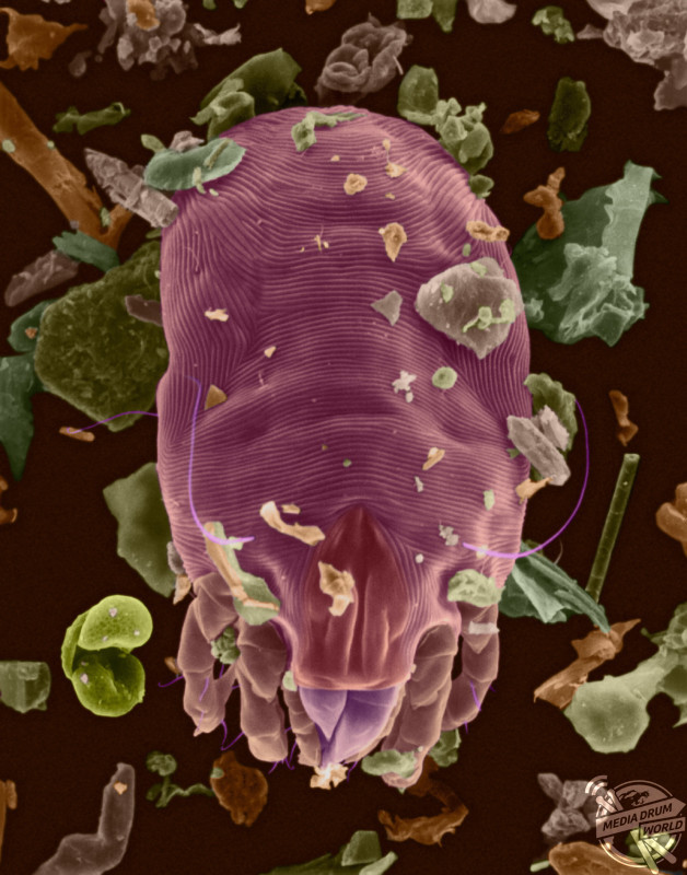 Coloured scanning electron micrograph (SEM) of Dust mite (Dermatophagoides sp.). Millions of dust mites inhabit the home, feeding on dead human skin that are common in house dust. The mite's body is in three parts: the gnathosoma (head region) adapted for feeding on dead skin, the propodosma (carrying the 1st and 2nd pair of walking legs) and the hysterosoma (locating the 3rd and 4th pairs of legs). Dust mites produce 10-20 waste particles per day. The dead bodies and faecal pellets can trigger allergic responses. The whole life cycle from egg to adult takes approximately one month to complete, mature female mites can lay from 1-2 eggs per day. Adult mites can live up to two months. The most important house dust mites worldwide are Dermatophagoides farinae and Dermatophagoides pteronyssinus. Magnification: x91 when shortest axis printed at 25 millimetres. SPL / mediadrumworld.com
