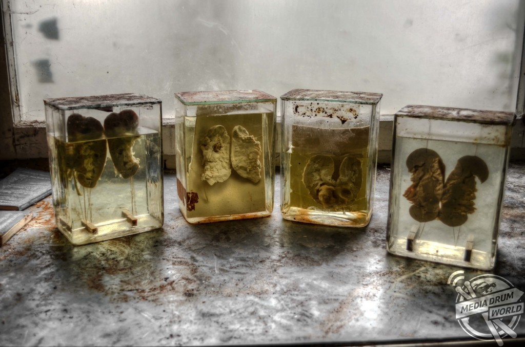 Human kidney specimens that have been left behind. Sascha Jung / mediadrumworld.com