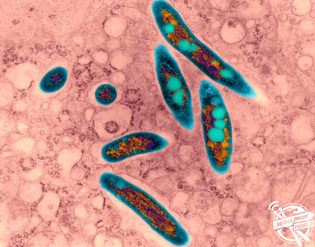 Coloured transmission electron micrograph (TEM) of Mycobacterium avium complex (MAC) infection (human lung). Dennis Kunkel Microscopy/ SPL / mediadrumworld.com