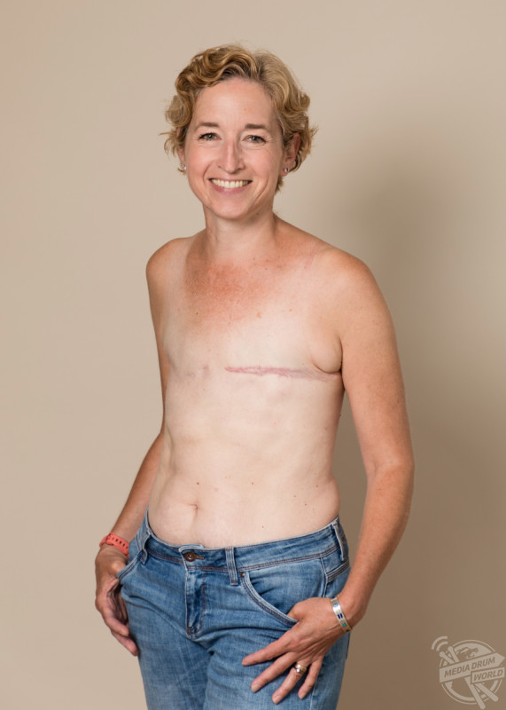 THIS BRAVE British mum-of-three is embracing her mastectomy scars and flat chest...