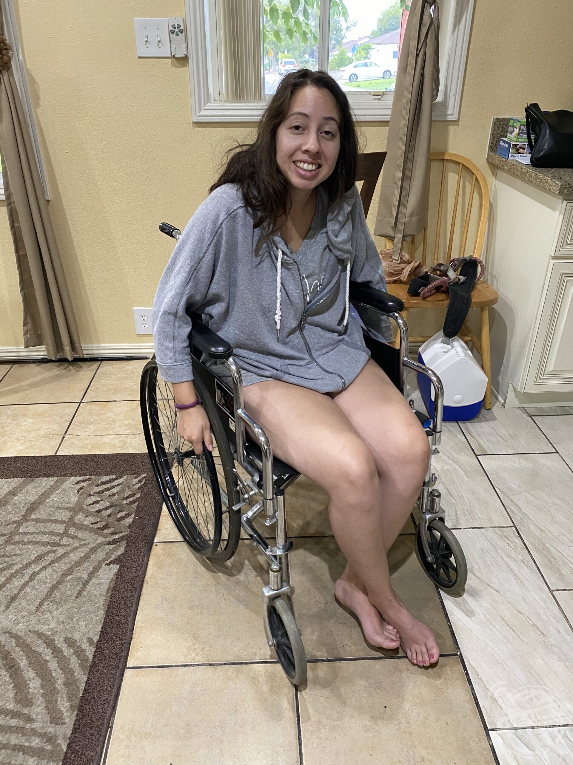 This Woman Was Left In Wheelchair For Five Months After Contracting